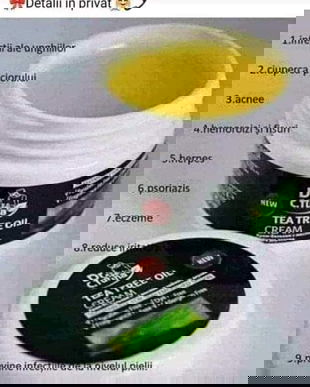 vergeturii hai sa le tratăm in doar 30 zile . Spune DA si noi iti dăm soluția